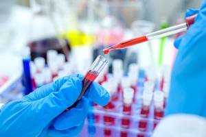 Efecto Lázaro, el tratamiento efectivo que se aplica a pacientes de coronavirus