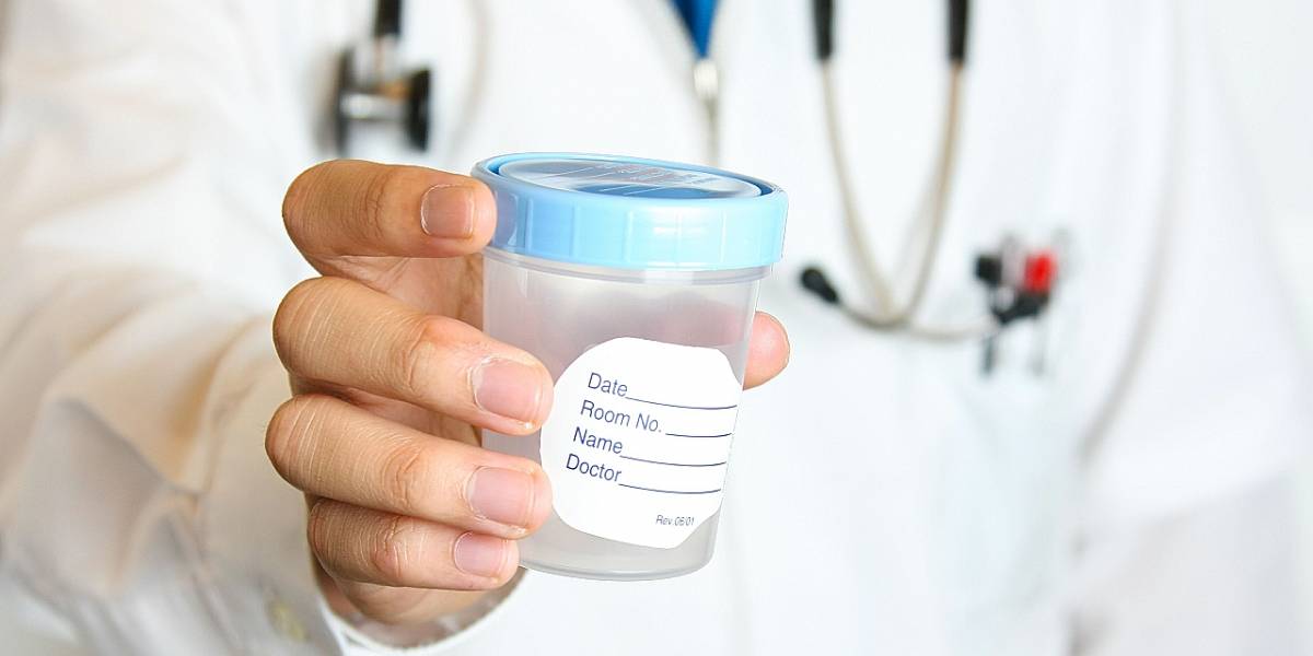 Coronavirus: científicos chinos detectan al COVID-19 en el semen de hombres contagiados