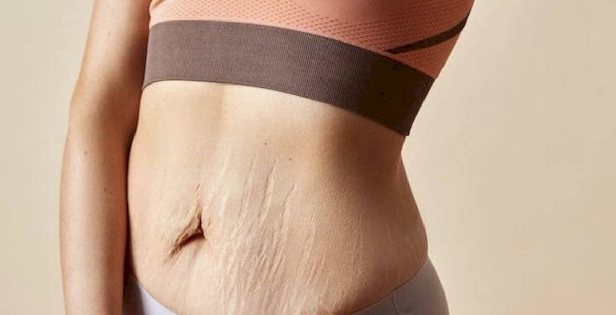 CUERPO