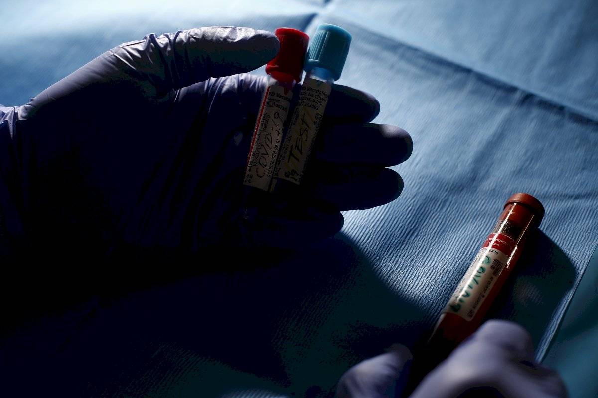 coronavirus