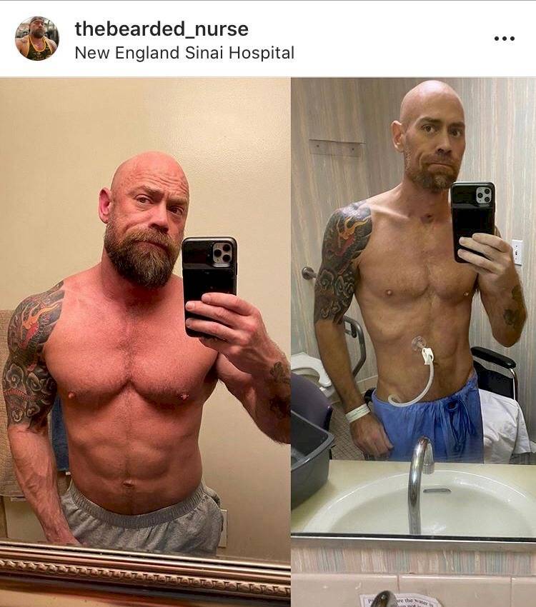 viral