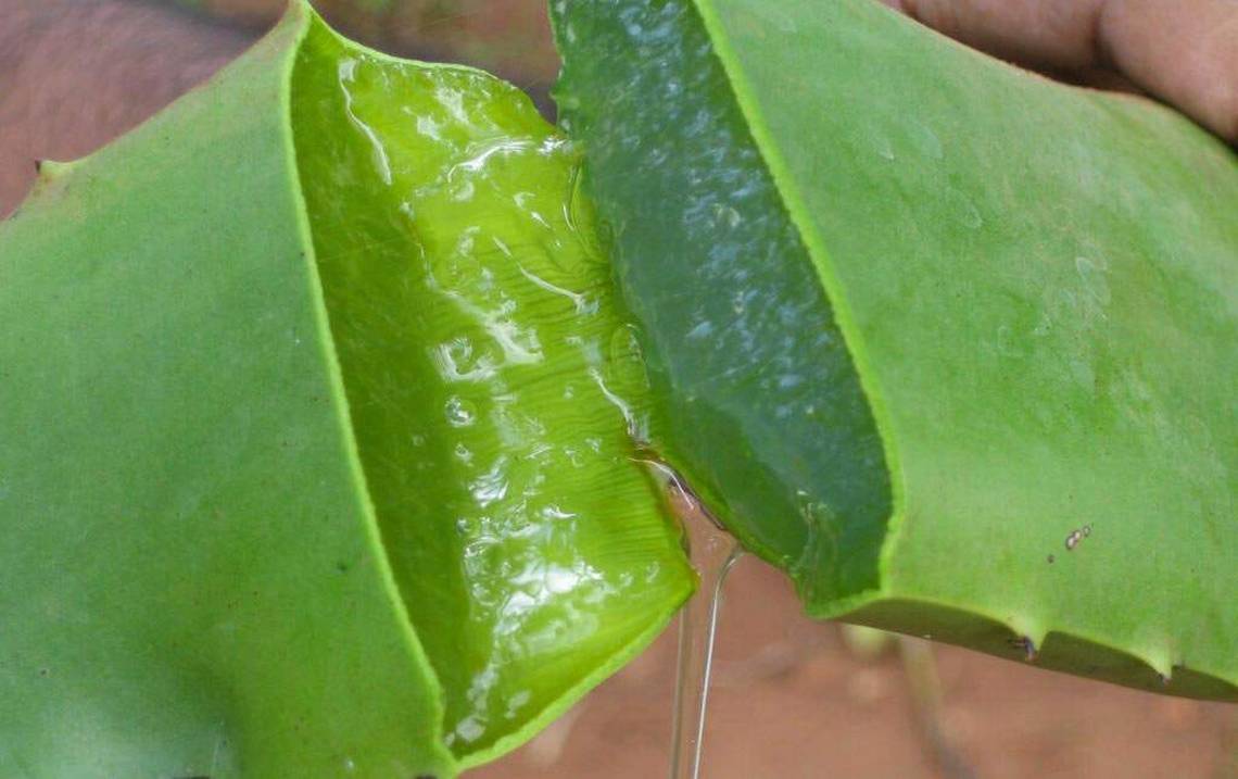 La pulpa de la sábila con el limón son un potente aliado contra el acné Acné