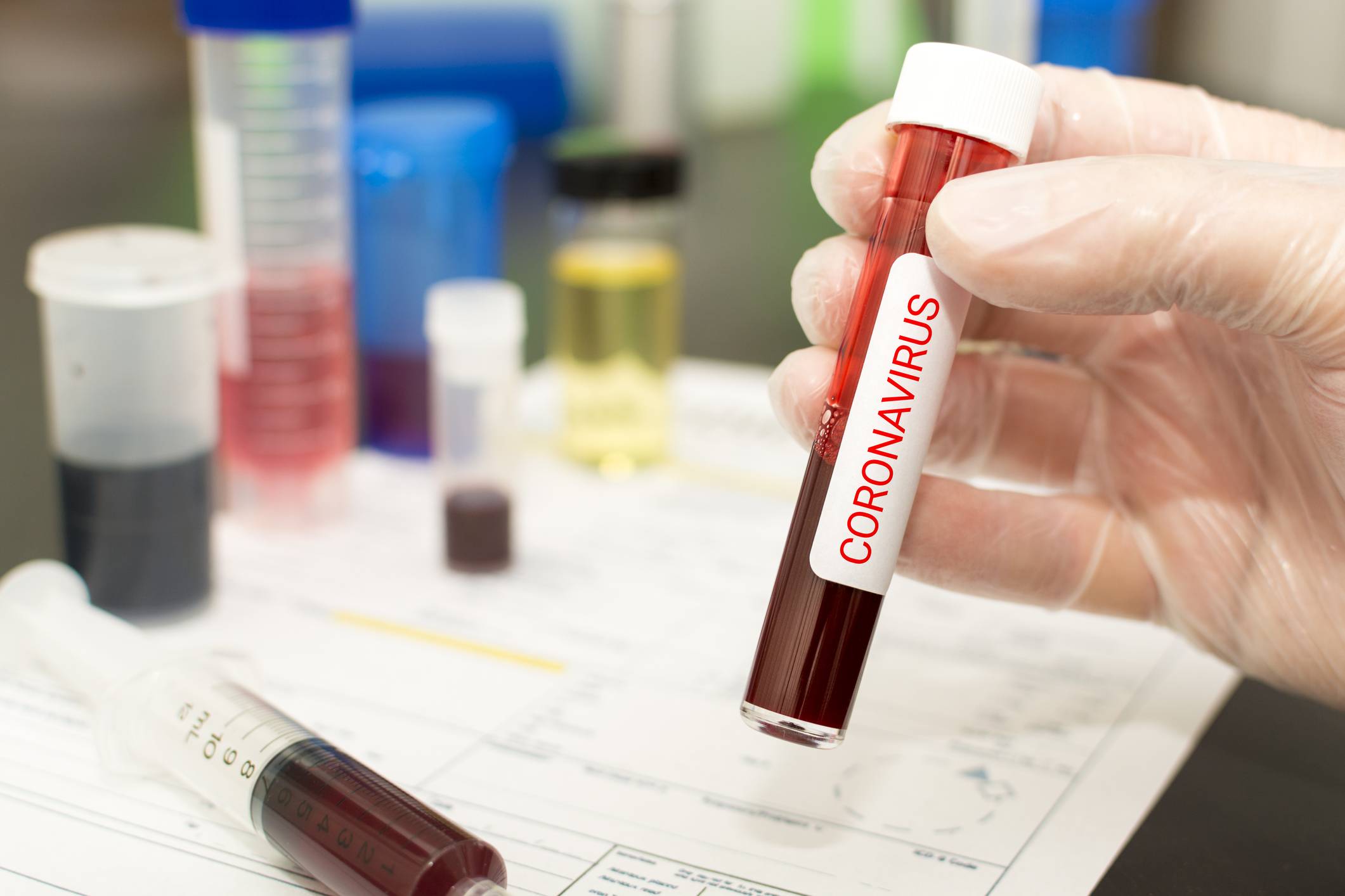 coronavirus