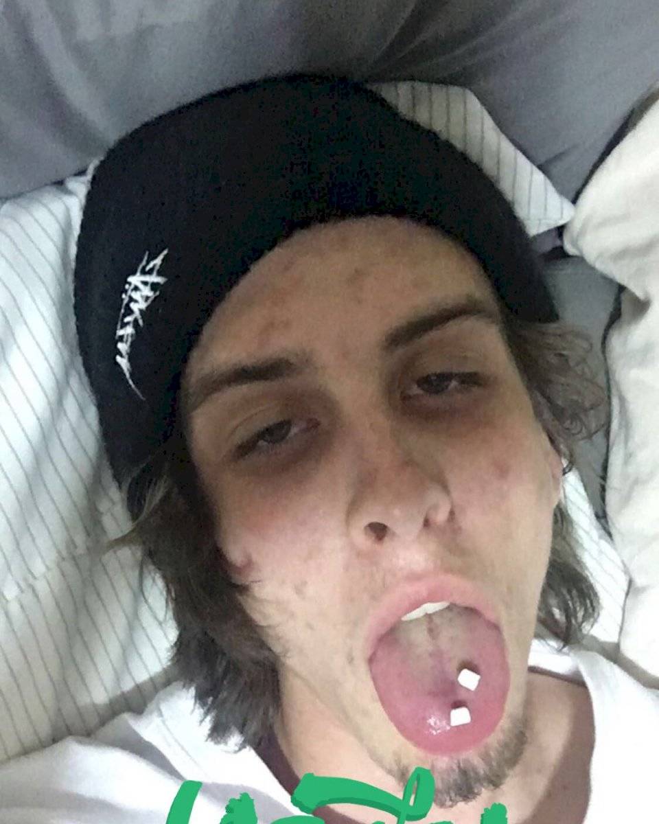 Travis, joven que dejó el consumo de las drogas