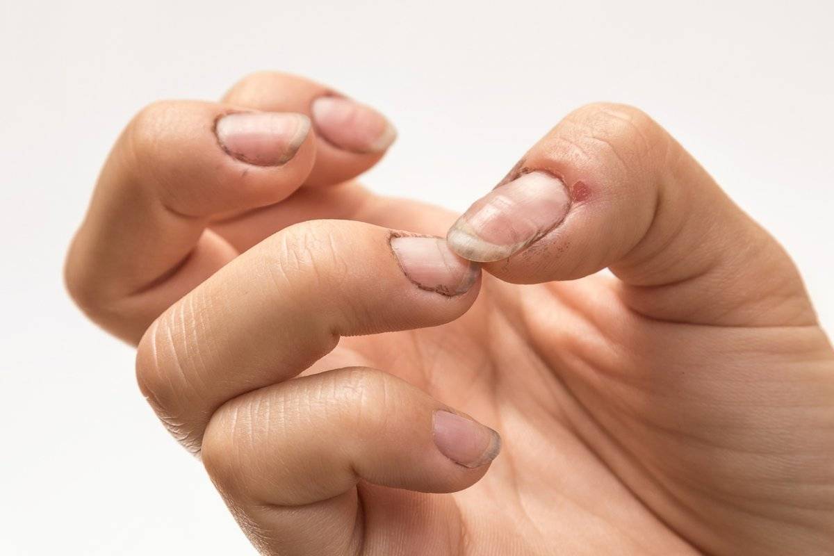 El espacio entre las uñas y la piel de los dedos es un lugar perfecto para la proliferación de bacterias