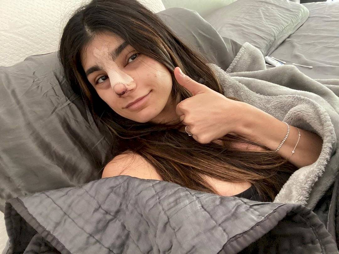 Mia Khalifa se operó la nariz