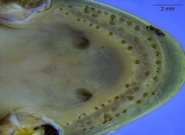 Dientes Gusanos Cecilias