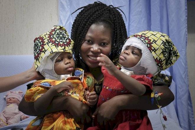 A mãe, Ermina, e as gêmeas Ervina e Prefina pós-cirurgia