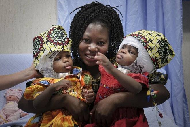 A mãe, Ermina, e as gêmeas Ervina e Prefina pós-cirurgia A mãe, Ermina, e as gêmeas Ervina e Prefina pós-cirurgia