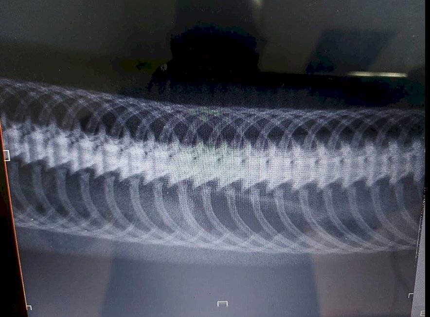 Radiografía de una anaconda