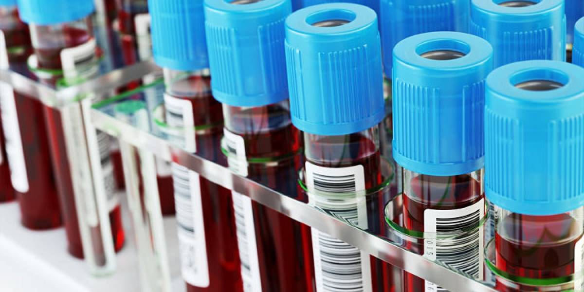 COVID-19: Un análisis de sangre detectaría riesgo de morir por coronavirus