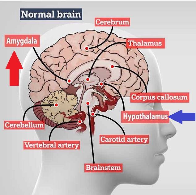 Cerebro Cerebro