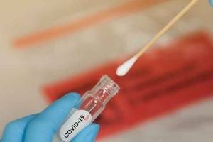 examen-prueba-coronavirus