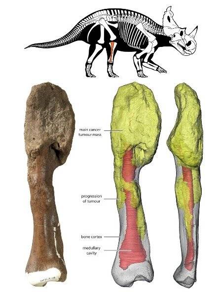  Cáncer de huesos sufrido por un dinosaurio 