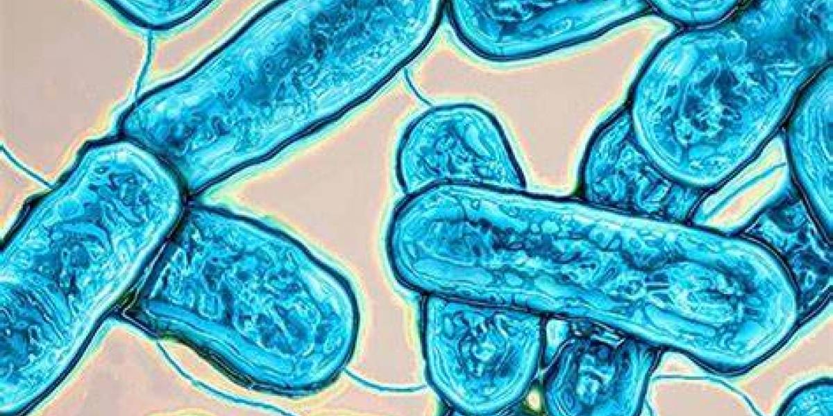 Descubren bacteria en oficinas que estuvieron cerradas por la cuarentena