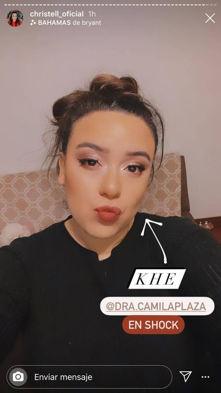 Christell Rodríguez se sometió a una bichectomía Christell Rodríguez se sometió a una bichectomía