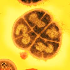 Deinococcus radiodurans Deinococcus radiodurans