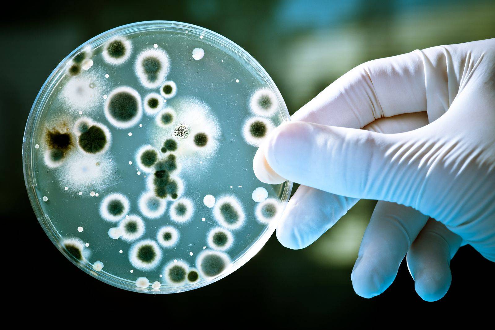  infecciones 