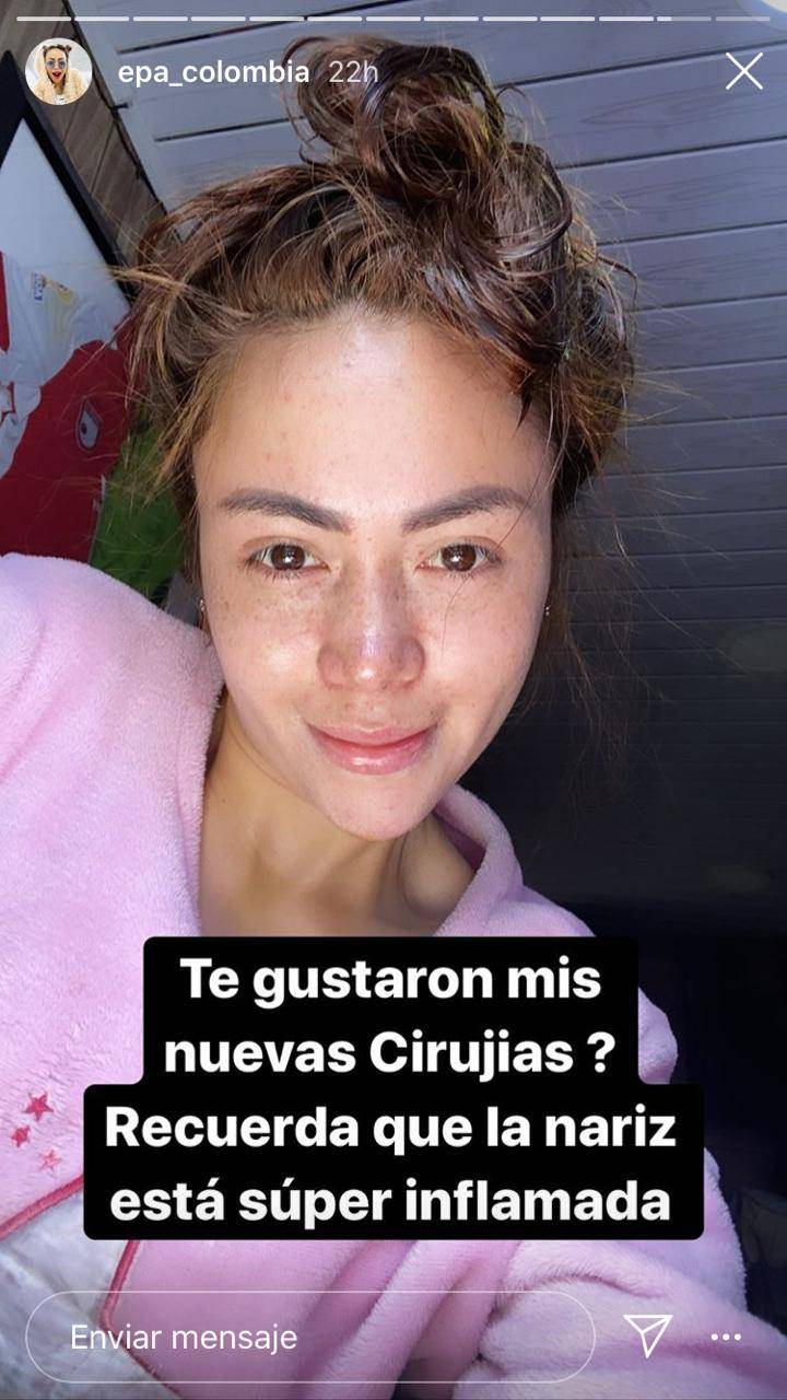 Epa colombia