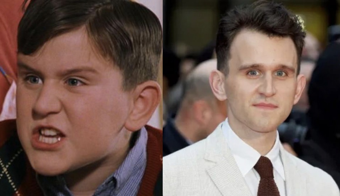 Harry Melling Harry Melling