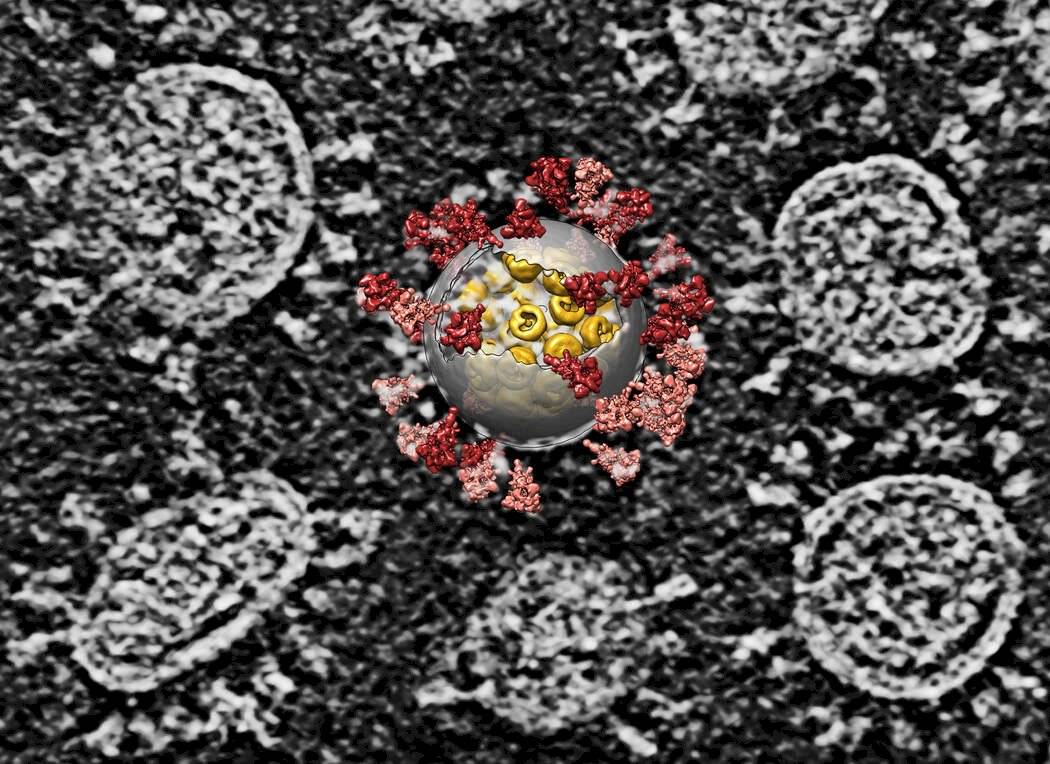 Una reconstrucción por computadora superpuesta sobre una imagen de varios virus del SARS-CoV-2