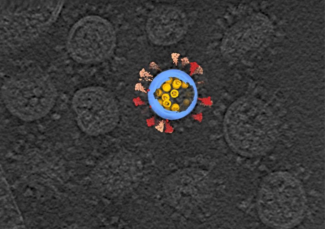 Una imagen de tomografía crioelectrónica de los virus SARS-CoV-2, en gris, con una reconstrucción por computadora de un virus.