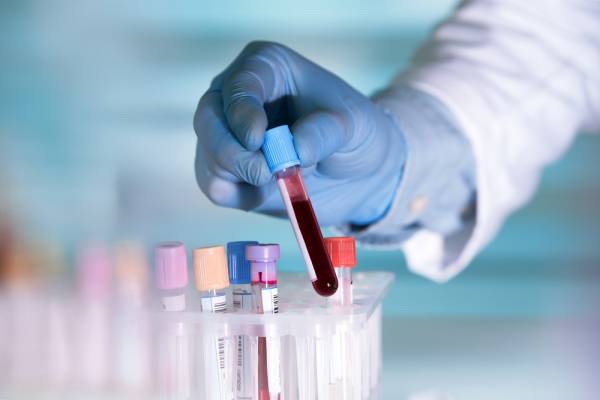 Pensó que era covid, pero era leucemia: hombre de 31 años necesita urgente un donante de células madre