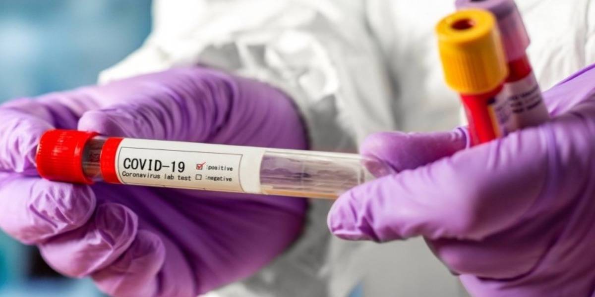 Coronavirus: doctores estudian fármaco para la gripe que funcionaría contra el Covid-19