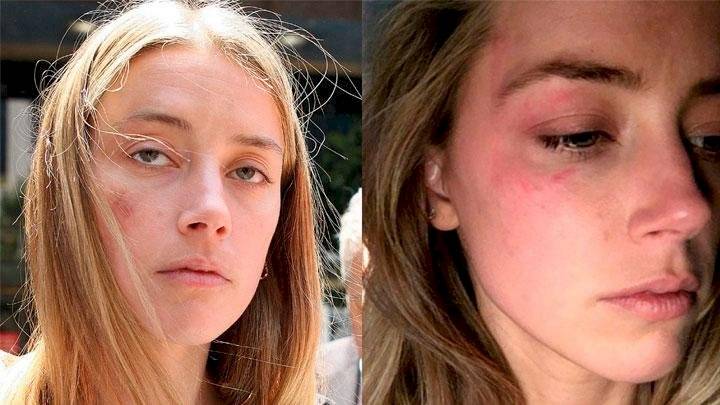 Fans de Johnny Deep piden que su ex también quede fuera de "Aquaman 2"
