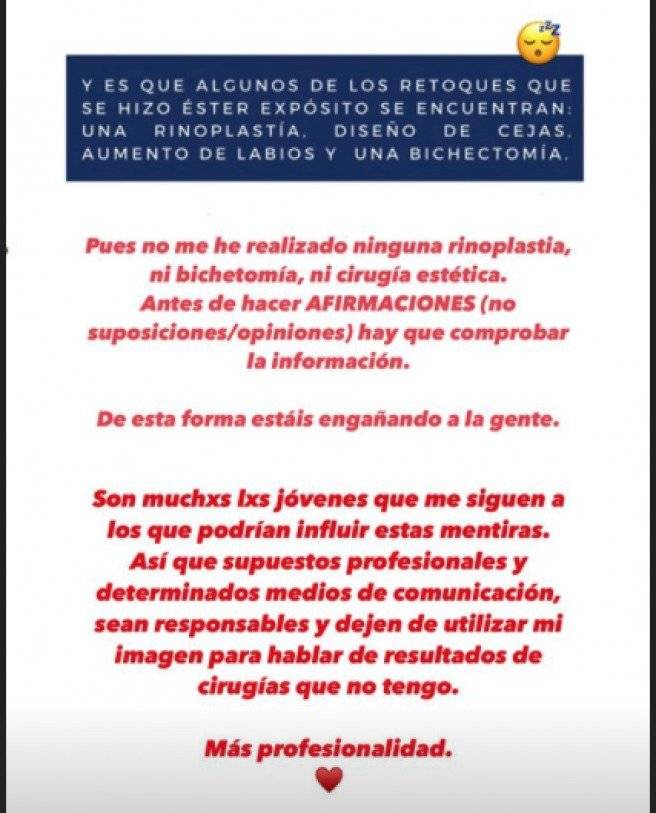 Ester Expósito pone fin a los rumores y asegura que no se ha operado nada