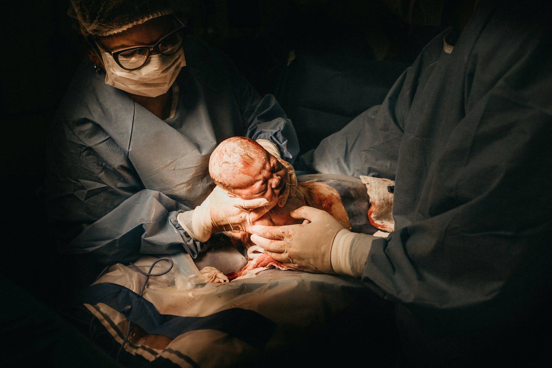 La cesárea es una intervención quirúrgica que se practica para el nacimiento de un bebé. Cesárea