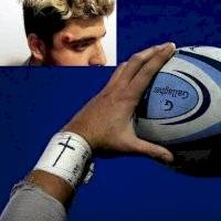 ¡Increíble! Jugador de rugby recibe balazo en la cabeza y solo sufre fisura
