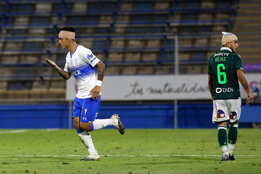 Valber Huerta (UC) y Gabriel Rojas /SW) terminaron el partido con vendajes