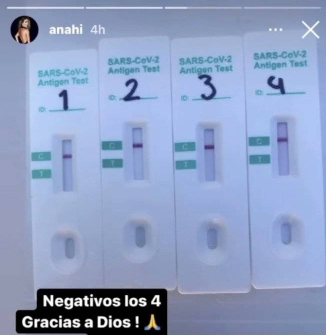 Anahí: "Me contagié de COVID-19 en el concierto tributo de RBD"