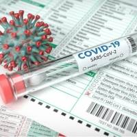 Salud reporta cuatro muertes y 679 nuevos casos positivos por coronavirus