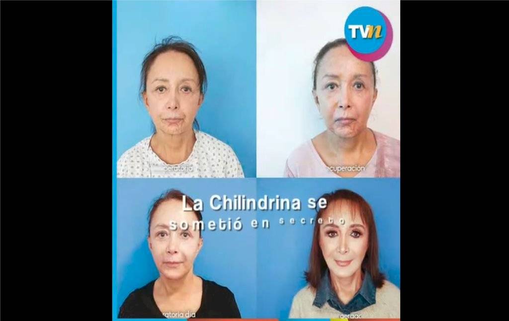 chilindrina1024x-1b2b452afd82632d51eedef63c55eb85.jpg